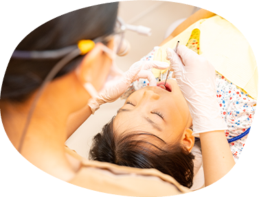 こどもの虫歯管理(3~11歳)